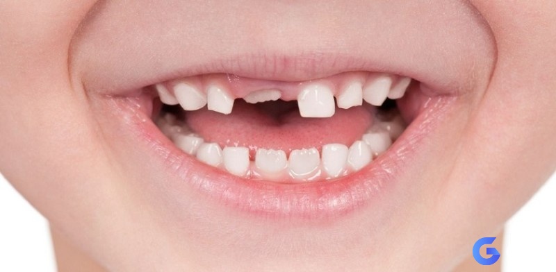 Giấc mơ được giải mã dựa theo trường hợp cụ thể 
