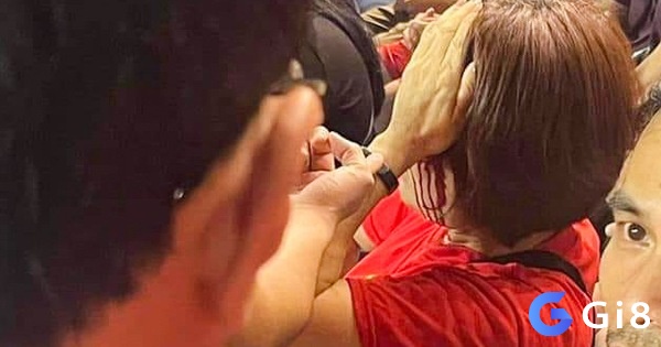 Ngủ mơ đánh nhau chảy máu ám chỉ công việc của bạn sẽ gặp phải khó khăn và thách thức