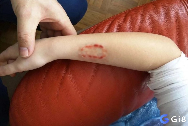 Vị trí bị cắn trong mơ chính là chìa khóa giúp bạn tìm ra con số chuẩn xác khi mơ thấy bị người cắn đánh con gì.